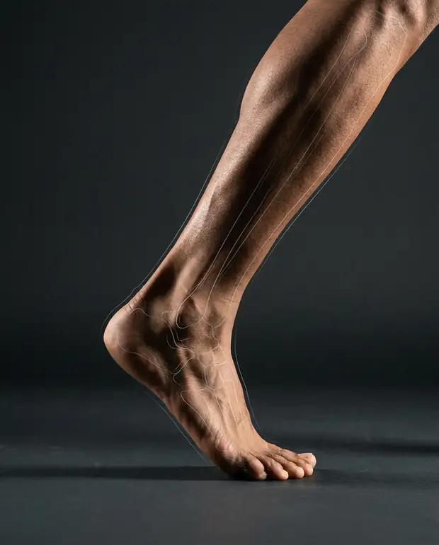 Ankle / Foot study for orthopaedic assessment